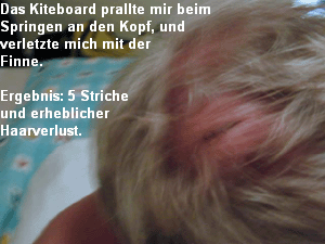 Kopfverletzung Kopfverletzung